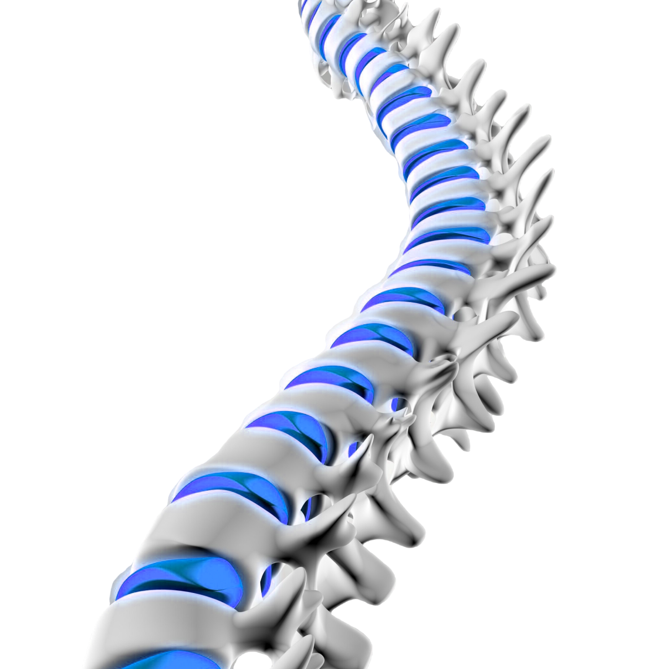 Spinal causes of lower back pain when sneezing